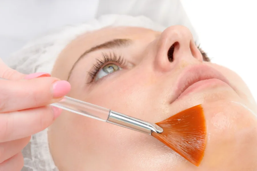 Peeling PRX-T33 – biorewitalizacja skóry twarzy bez igieł